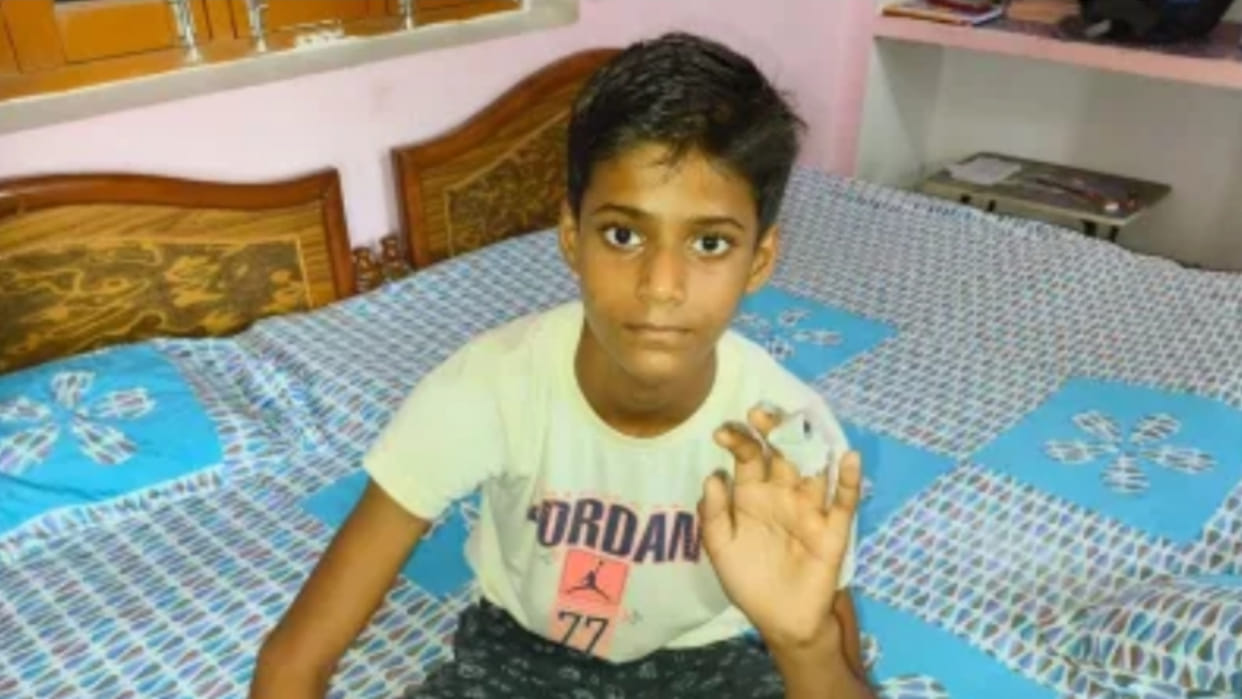 In a school Deoria, principal threw away severed finger of a student but did not get it treated.