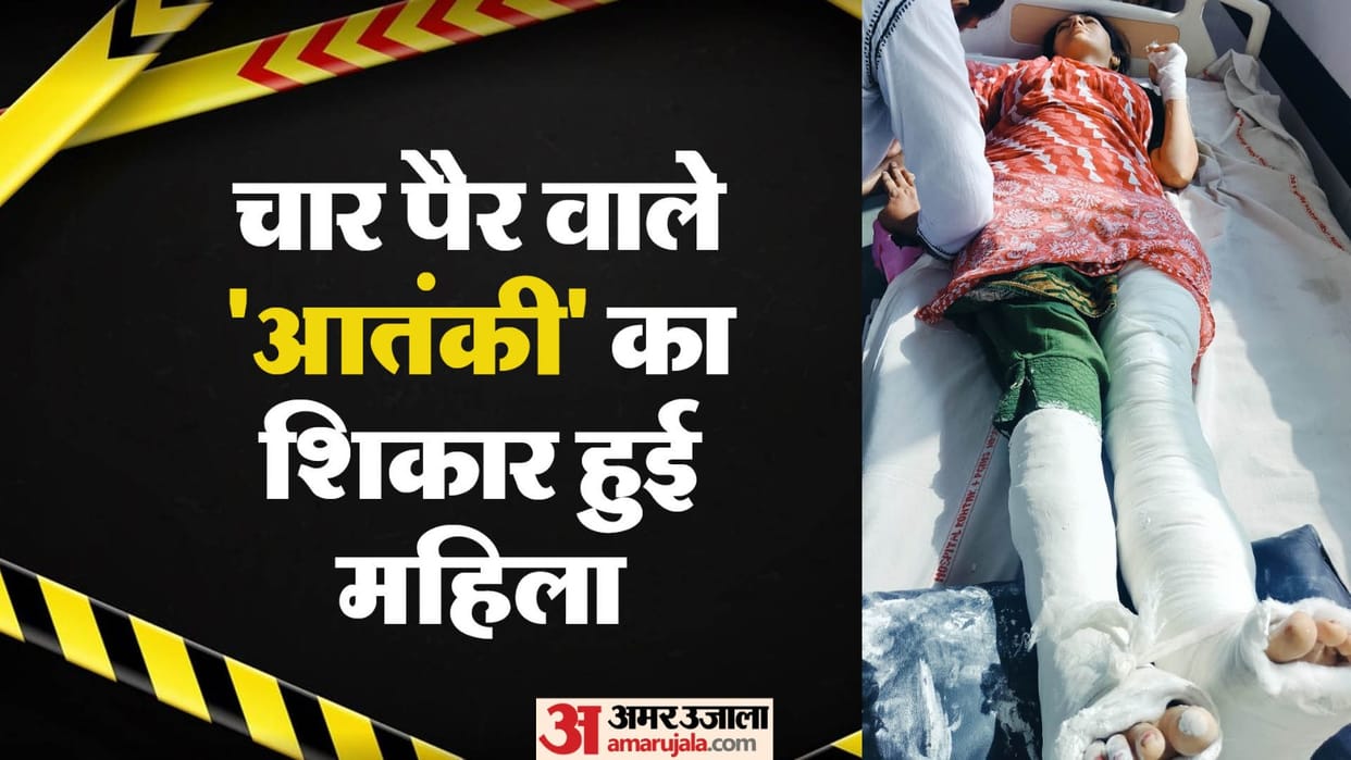 A woman fell from the roof due to fear of monkey attack both legs broke