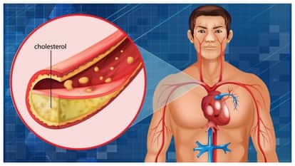 latest health study says low-carb diets may increase cholesterol level and risk of heart disease and stroke