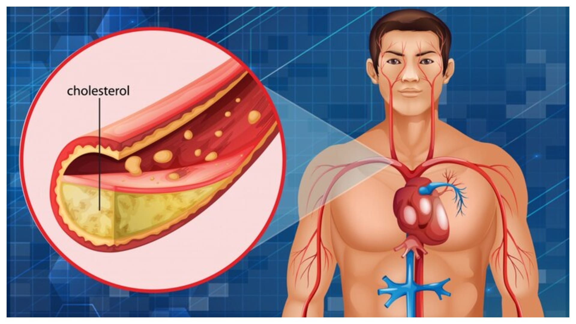 what is cholesterol in human body how high cholesterol is dangerous tips to control it