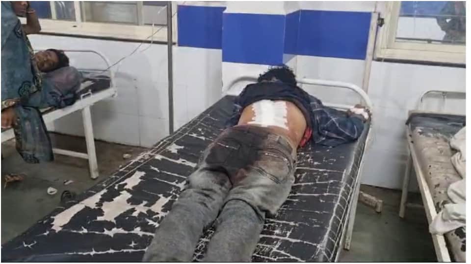 Agar Malwa Crime News Dispute Over Stale Chicken Youth Stabbed Villagers Set Hotel on Fire