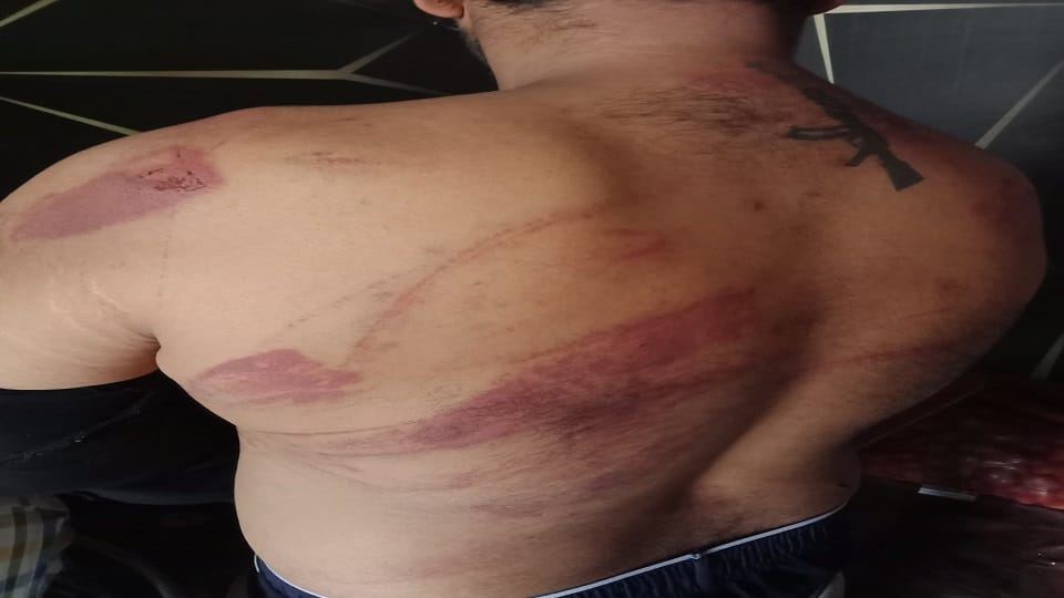 Meerut: Advocate was stripped naked, beaten, made to drink urine, brutalized for not giving his wife's mobile