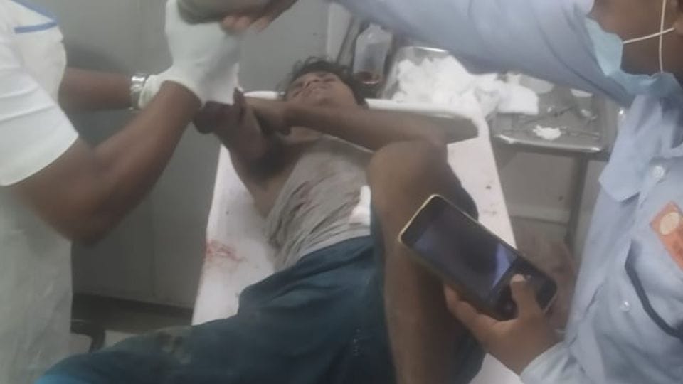 worker hand was chopped off while putting spices in the mixer machine In Jagdalpur