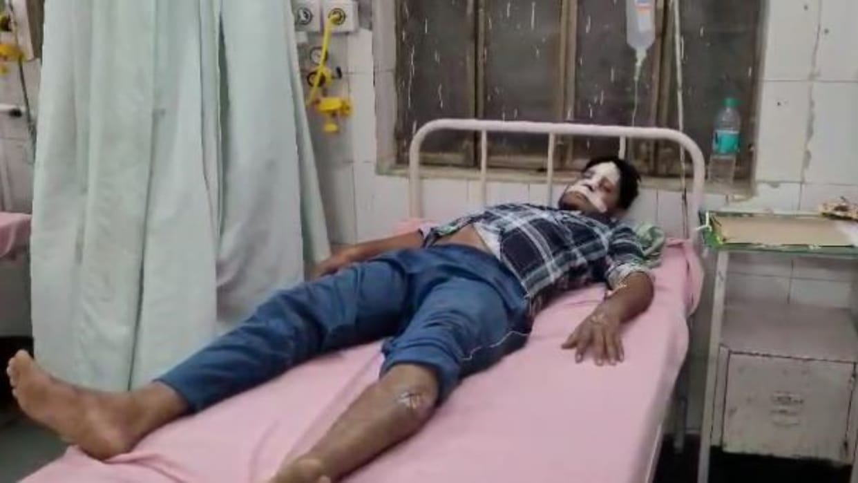 Alwar News : Electrocution from 11 thousand KV line, employee comes out of danger of death