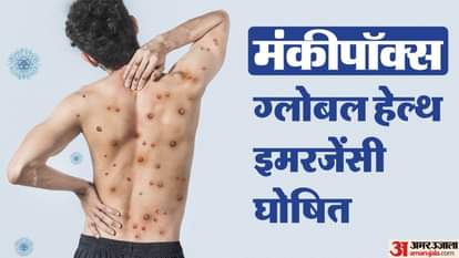 मंकीपॉक्स संक्रमण के मामले