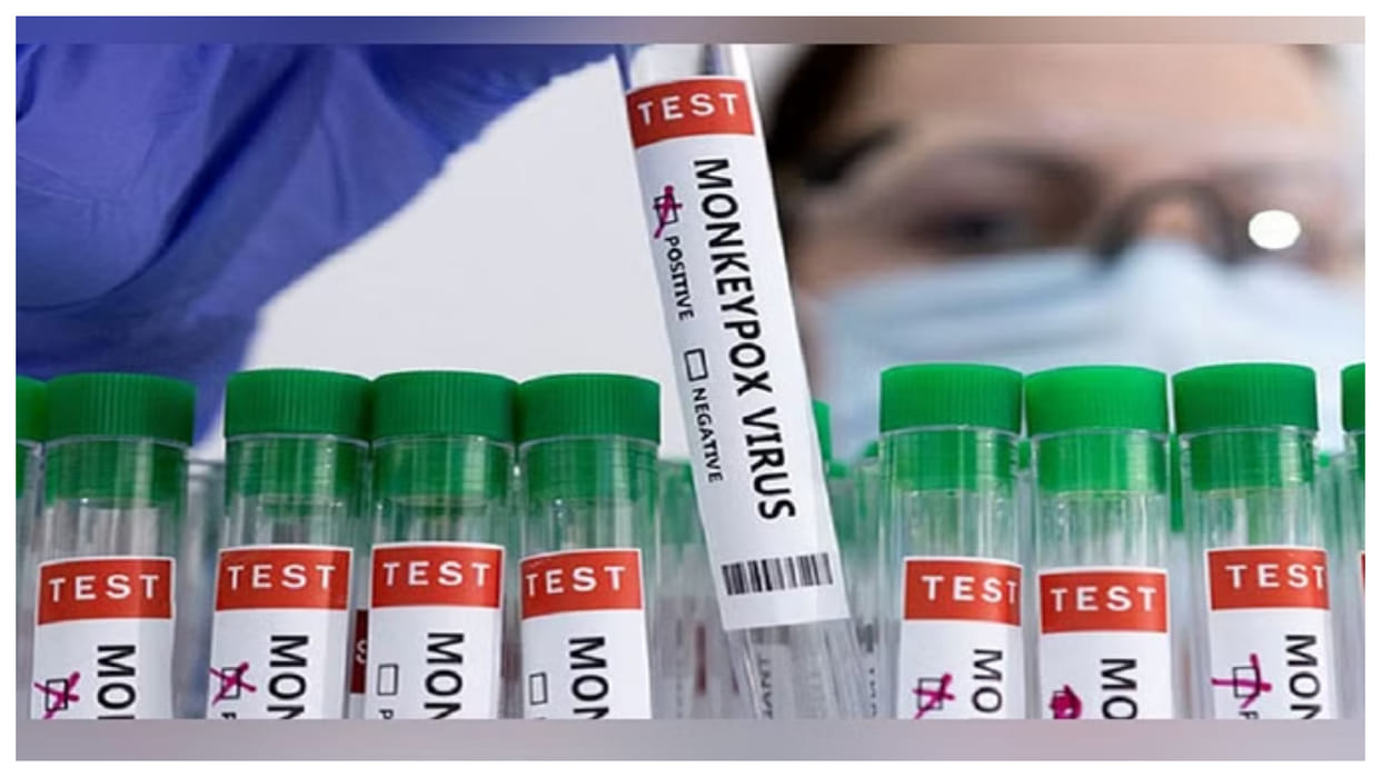 US officials gear up for potential mpox outbreak, adds testing to wastewater surveillance News in hindi