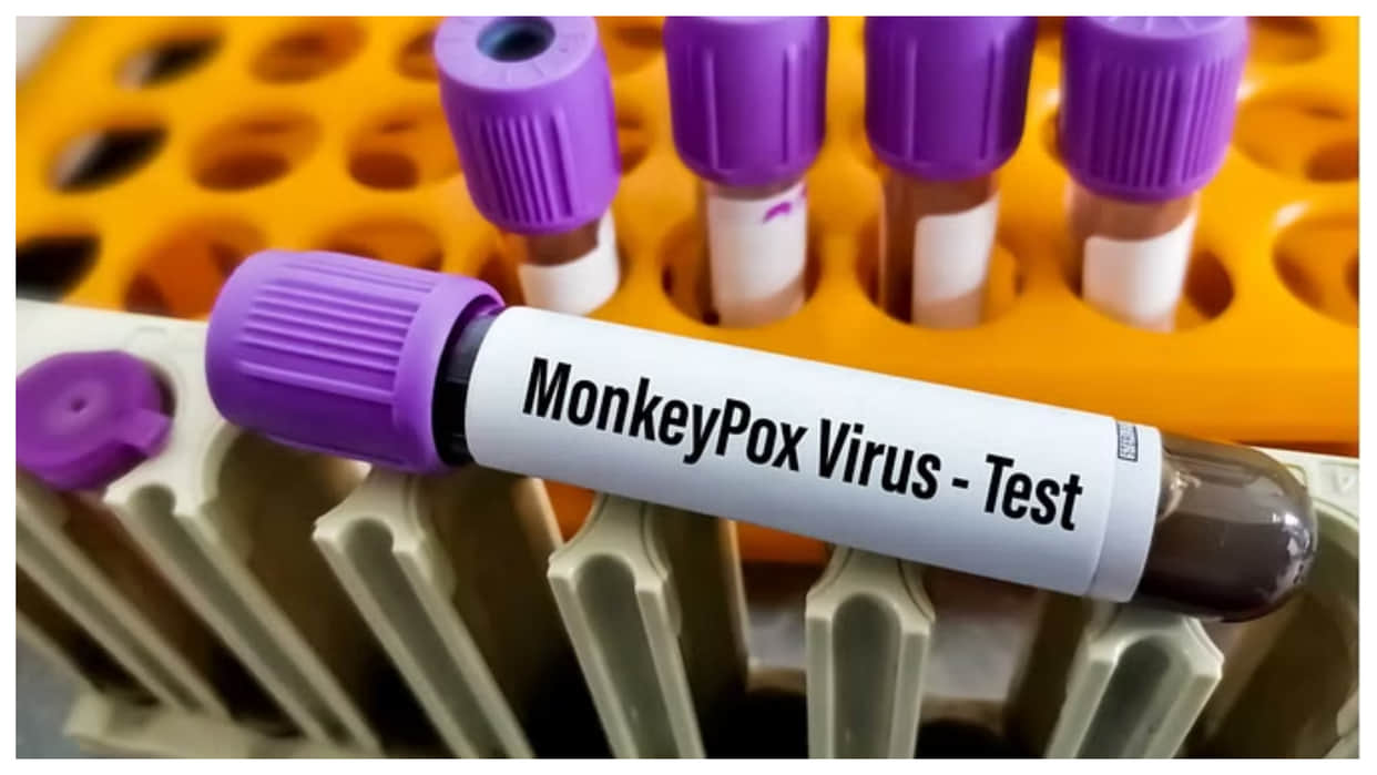 monkeypox latest news and updates in india know how mpox spread and its prevention