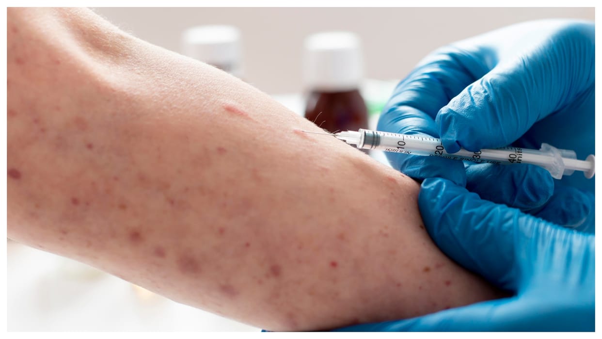 Monkeypox infection is continuously increasing more than 16 thousand infected in Congo 570 people died.