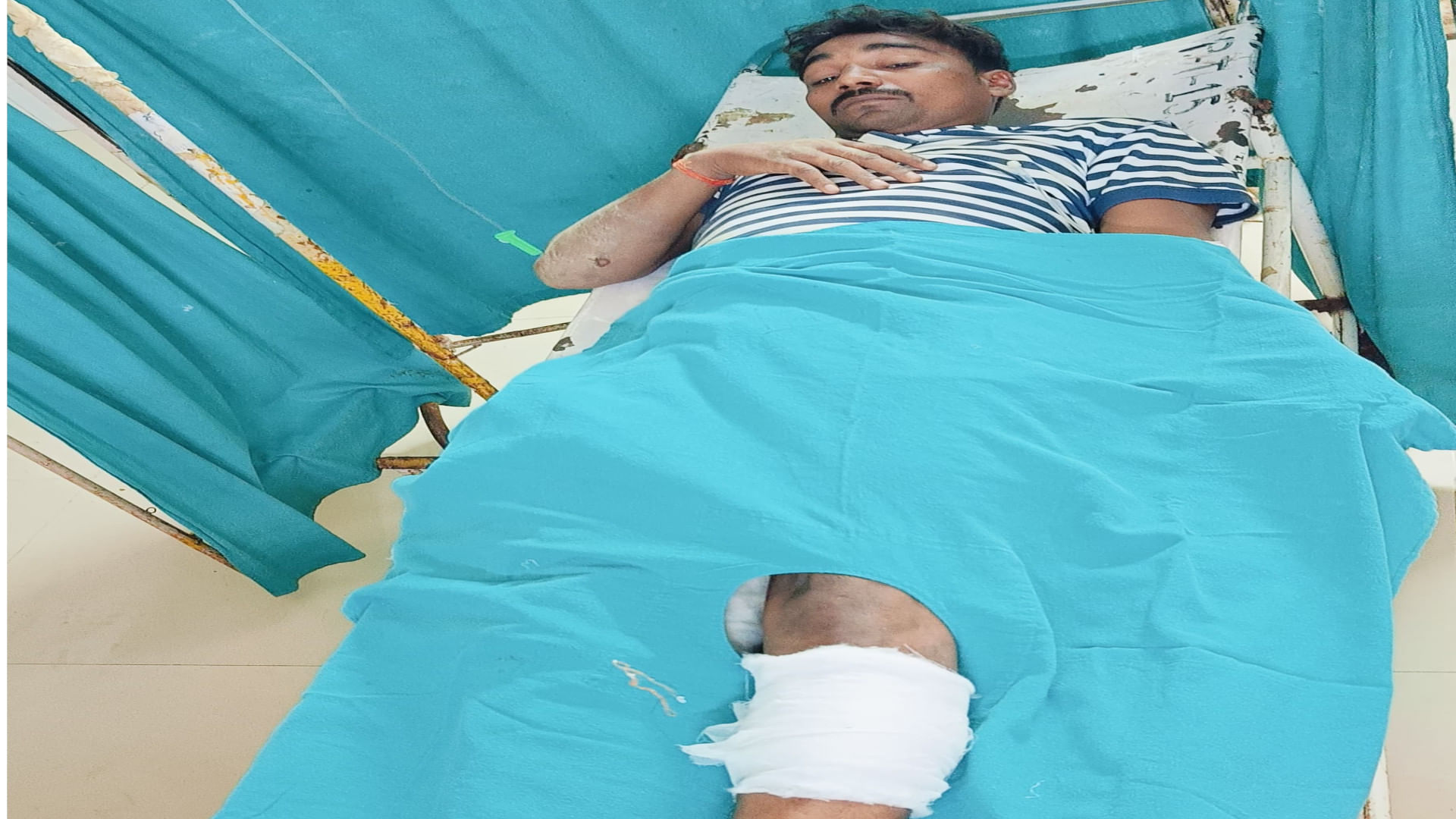 In Gorakhpur, Vicious Thief Shot In Leg In Encounter, Police Caught Him -  Gorakhpur News - Gorakhpur News:मुठभेड़ में शातिर चोर को पैर में लगी गोली,  पुलिस ने दबोचा- दर्ज मुकदमें जानकर