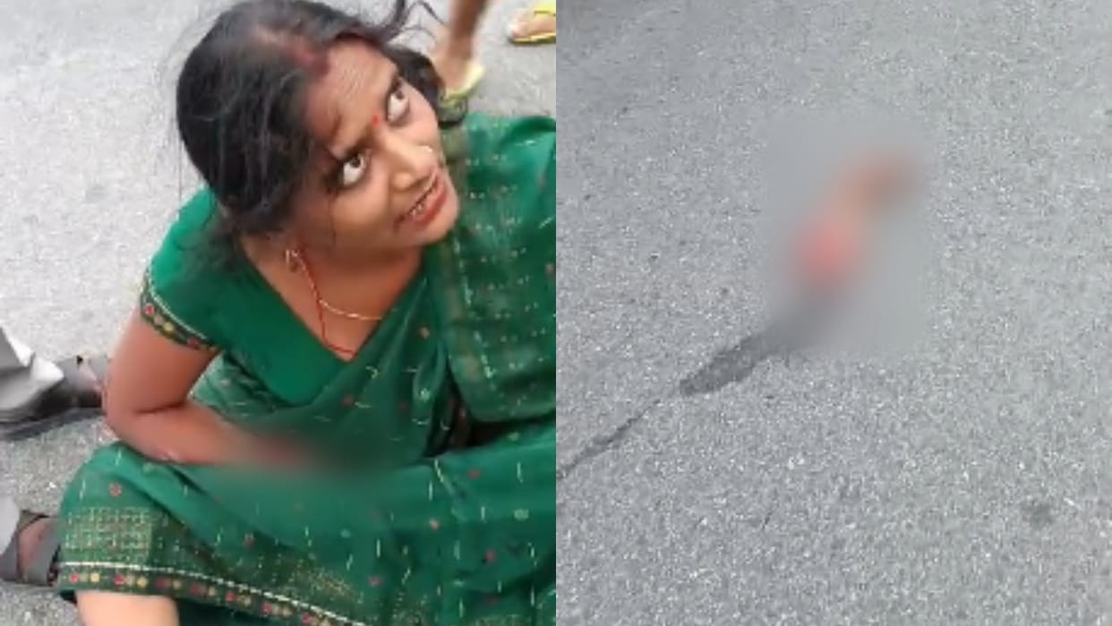 Woman's hand chopped off in road accident on Rakshabandhan
