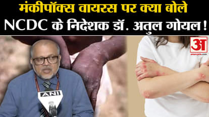 Mpox outbreak india: What did NCDC Director Dr. Atul Goyal say on monkeypox virus?