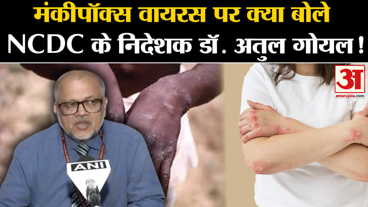 Mpox outbreak india: मंकीपॉक्स वायरस पर क्या बोले NCDC के निदेशक डॉ. अतुल गोयल!