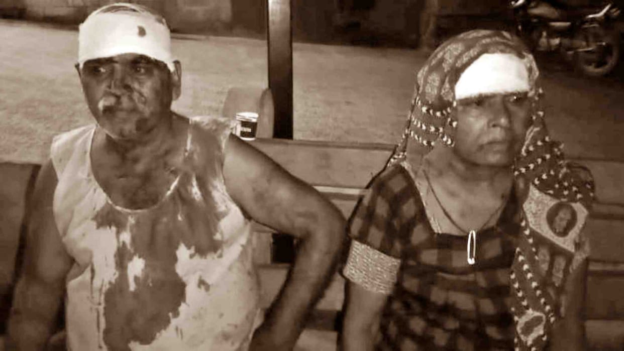 Alwar News: In Vaishali Nagar, a young man attacked a neighboring family with scissors