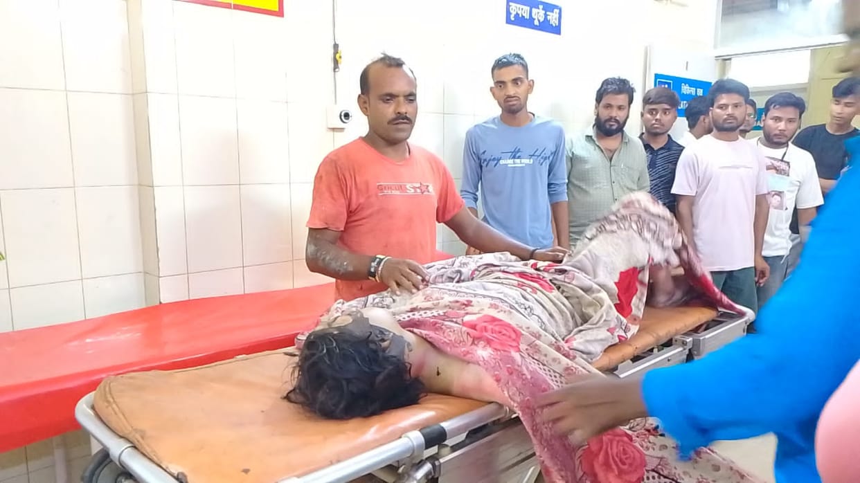 Husband scolded wife for beating child, wife poured oil and set her on fire, police engaged in investigation