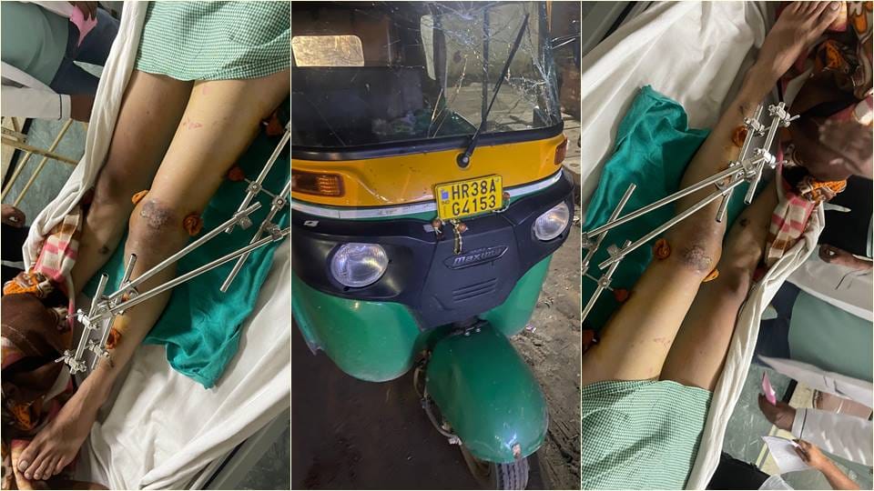 Auto driver hits student drags him for 300 meters for paying Rs 5 less fare in Ballabhgarh