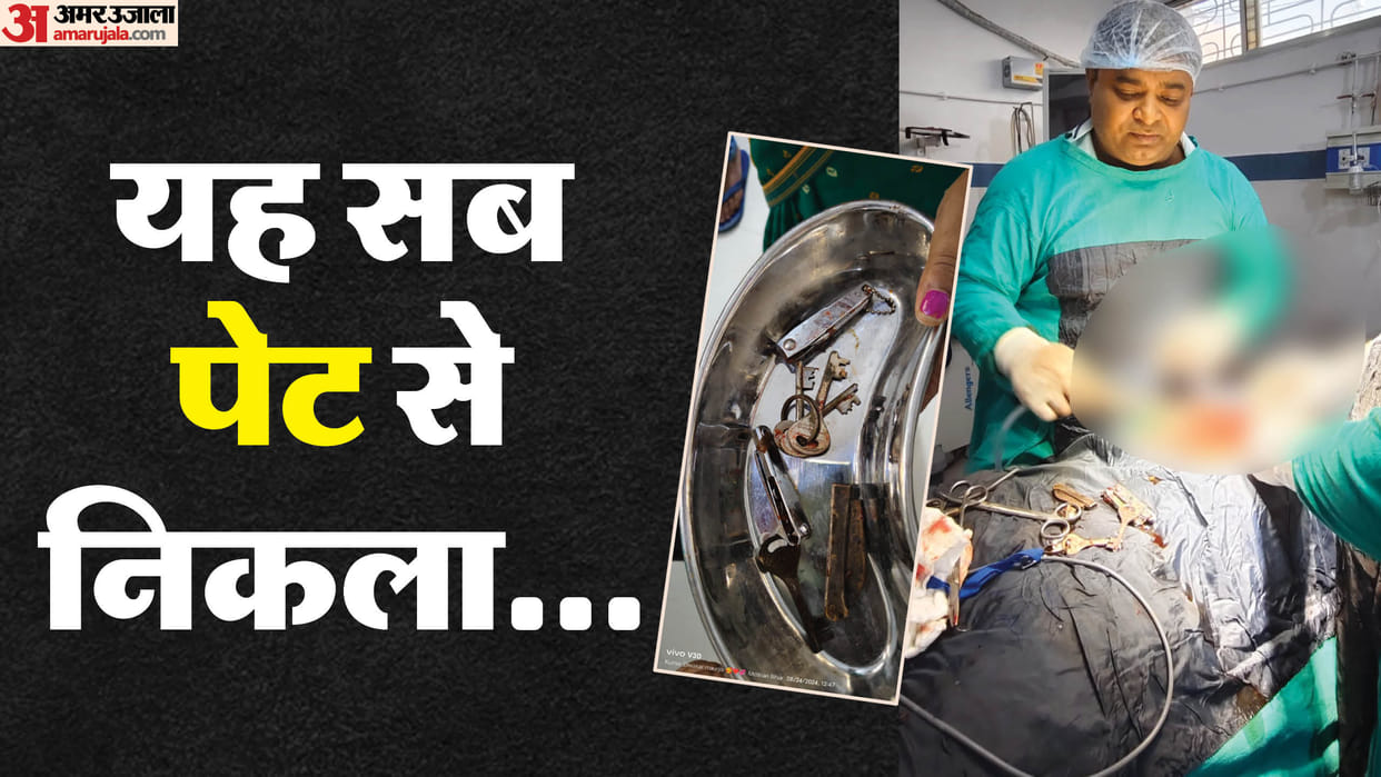 Bihar News: Boy swallows knife nail cutter and key in Motihari doctor takes him out of operation