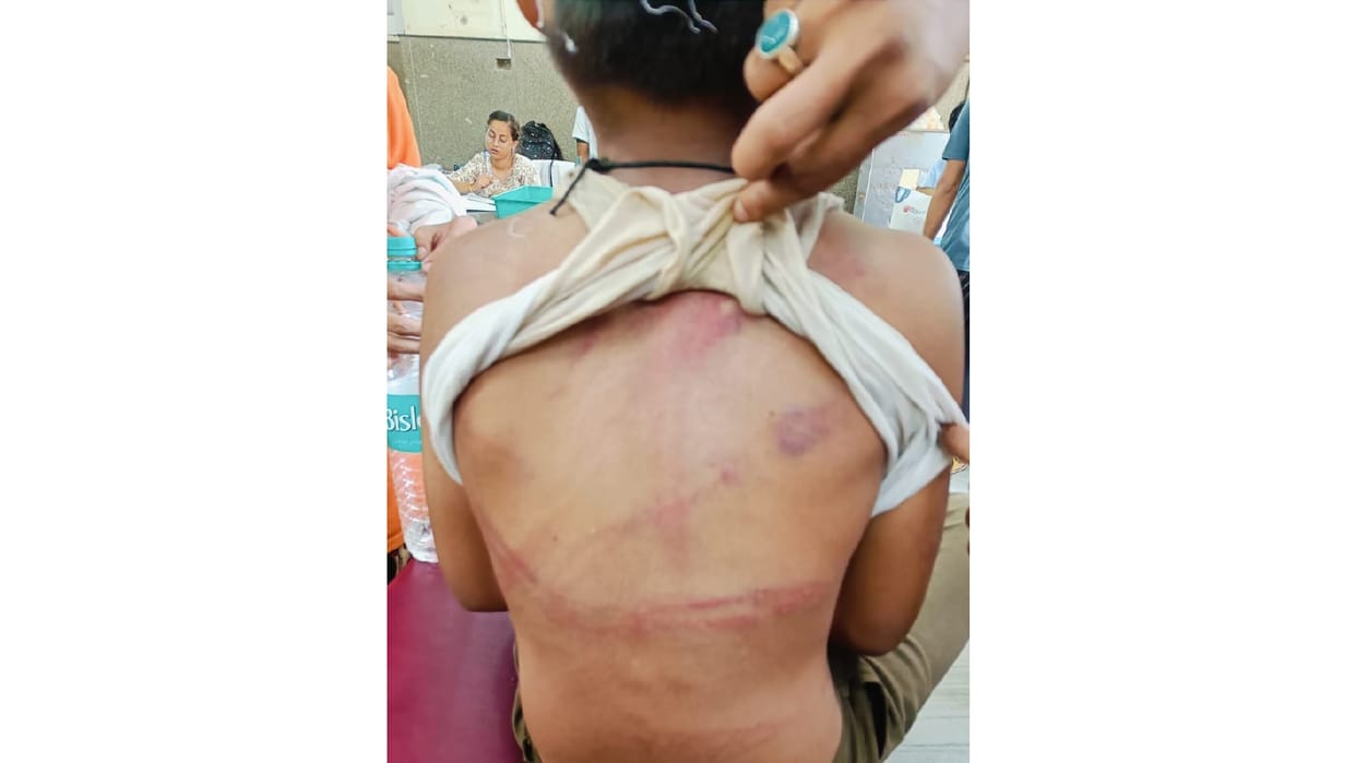 Bikaner News: Cruelty to child 9 year old innocent boy beaten with an iron pipe