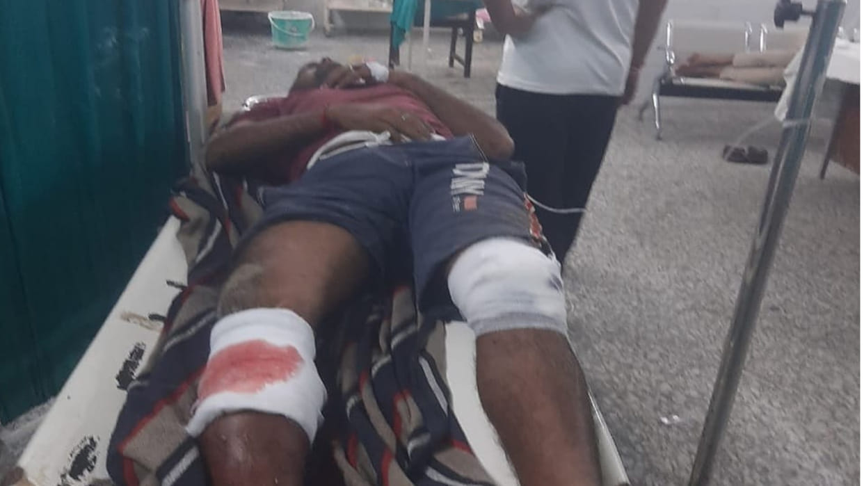In Khajni of Gorakhpur, cattle smugglers shot a man when he protested and beat him with bricks and stones