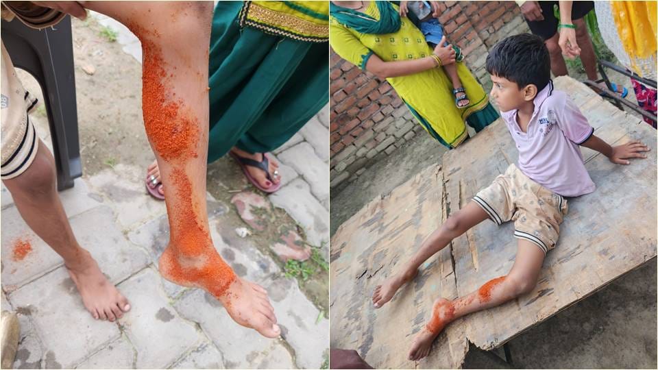 People forced to live in an environment of fear due to stray dogs in Greater Noida