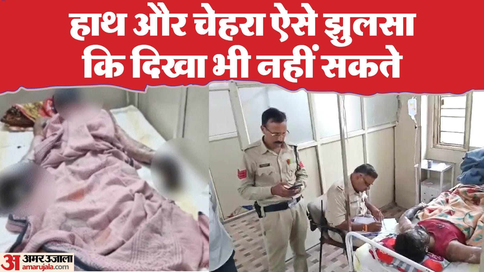 अस्पताल में भर्ती कर्मचारी।