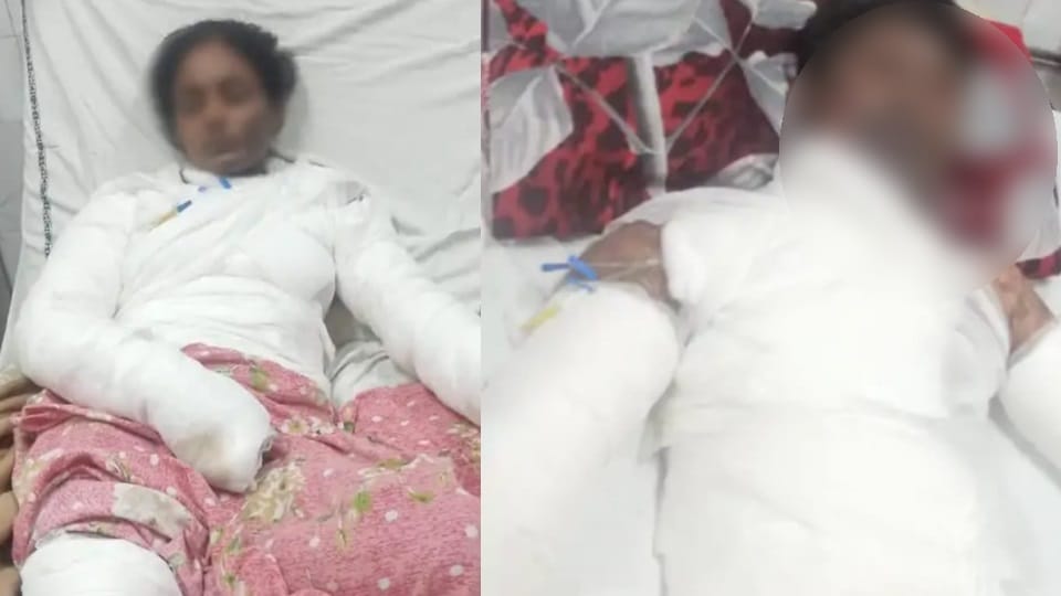Man burnt Girlfriend after refusing to marry, also set himself on fire in Khanna