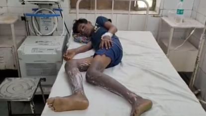 Alwar News: गैस सिलेंडर में लीकेज के कारण लगी आग, चाय की गैस बंद करने गया किशोर गंभीर रूप से झुलसा Alwar : Fire broke out due to leakage in gas cylinder, teenager who went to switch off the gas seriously burnt