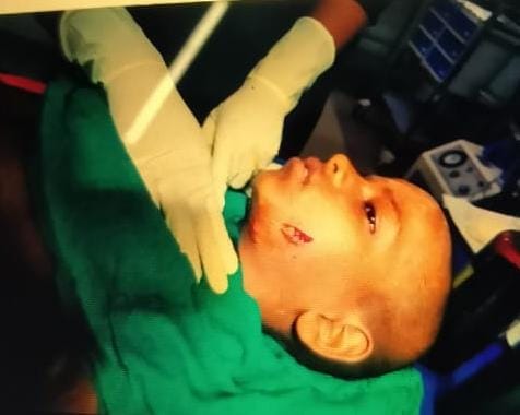 Bahraich: Wolf attack on a child in Dehat kotwali area.