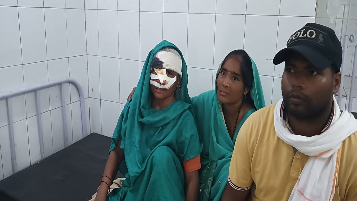 jackal attacked three villagers including women in Bareilly Bahedi