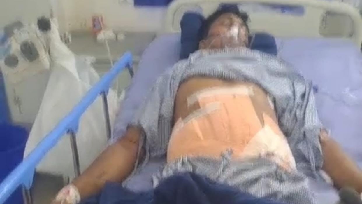 Begusarai: Criminal shot a young man for opposing against abuse while drinking tea