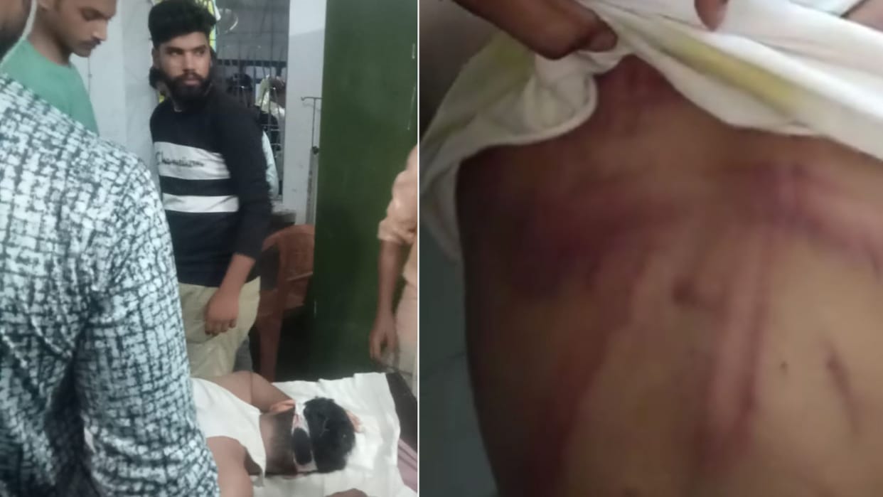 miscreants beat up teenager and injured in Ballia
