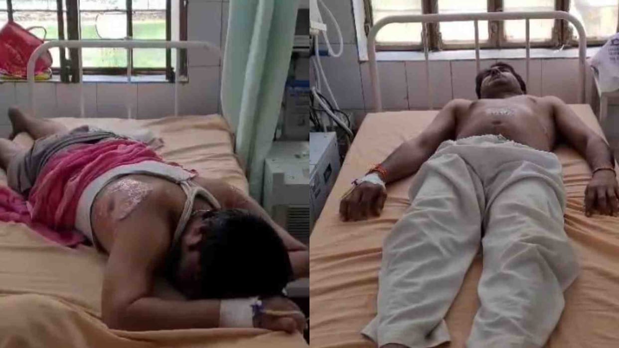 Alwar News: Uncle and nephew burnt due to negligence of electricity department