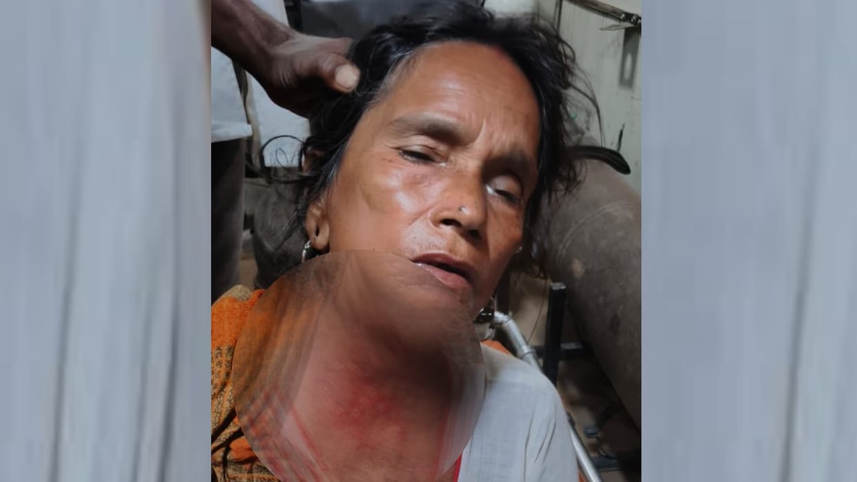 A wolf attacked on a woman in Kharighat thana in Bahraich.