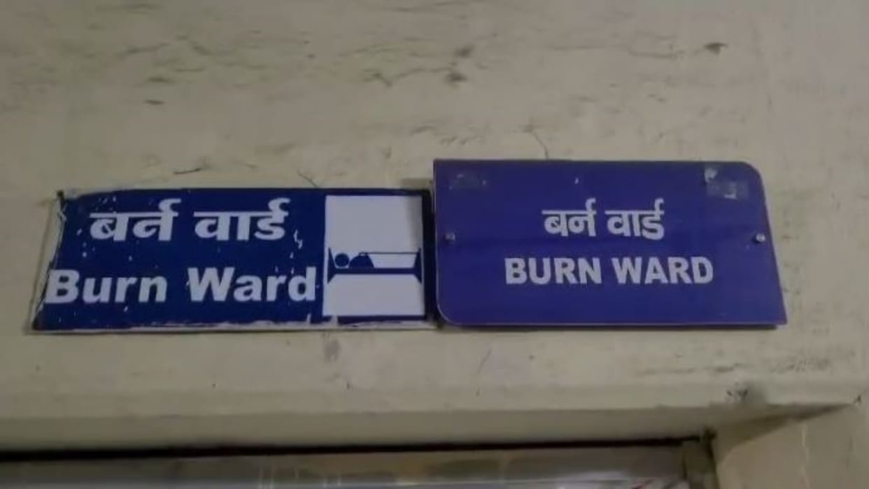 Alwar: 2 sisters got burnt due to falling boiling water, the accident happened while cooking corn on the stove