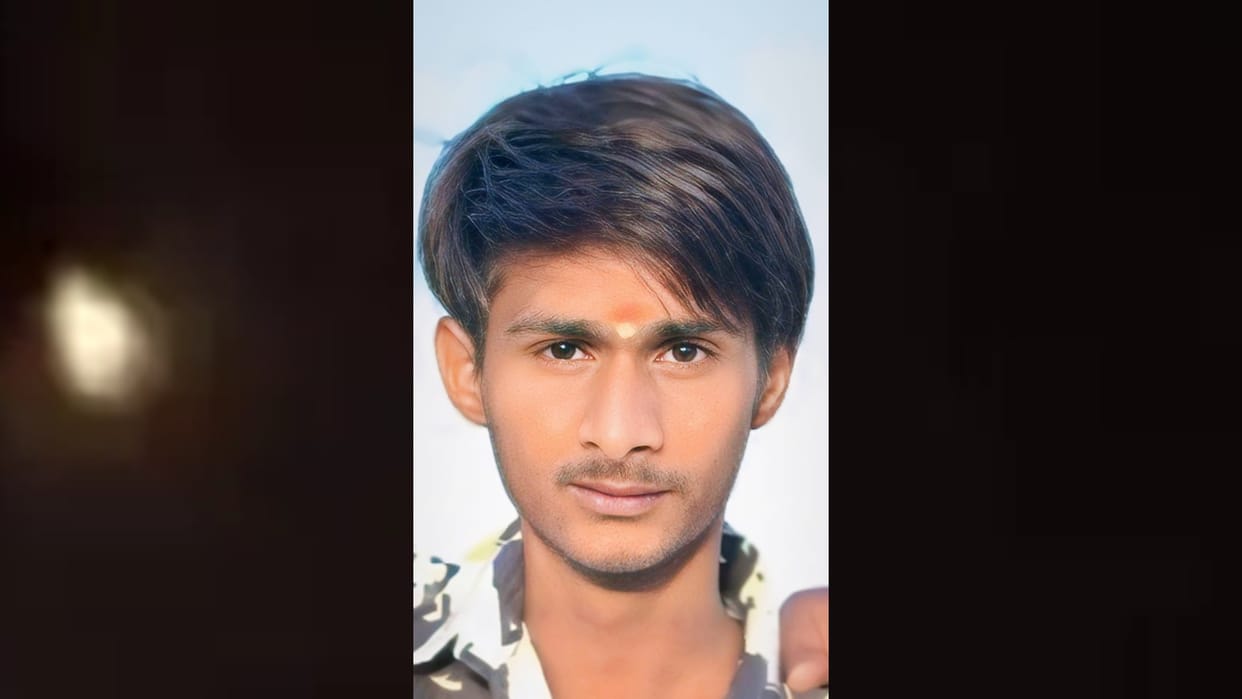 MP News: 17 year old youth dies of rabies in Ujjain bitten by stray dog a month ago
