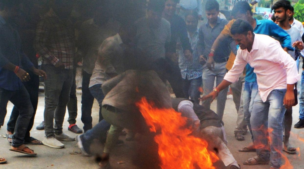 Difficulty in burning Akhileshs effigy, the leg of the BJYM district president got burnt
