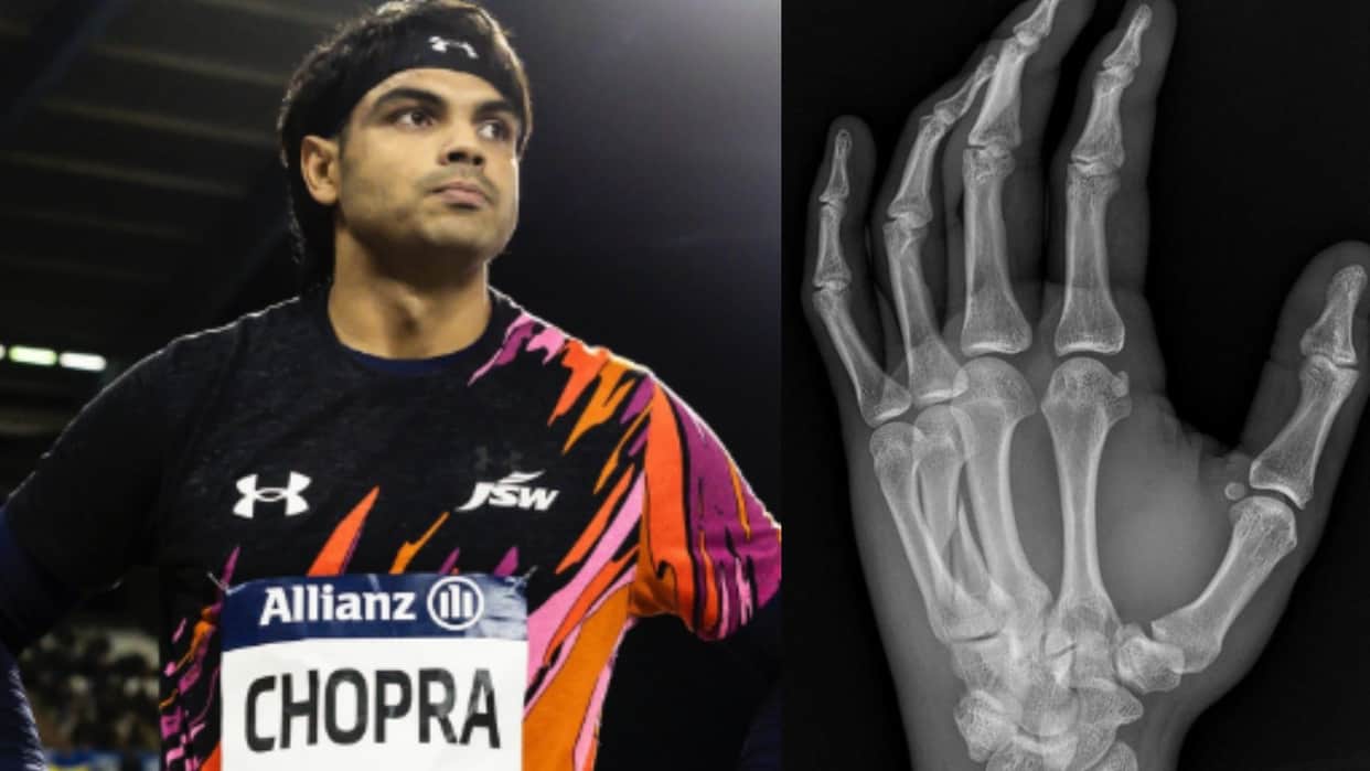 Neeraj Chopra entered the Diamond League final with a broken hand, revealed