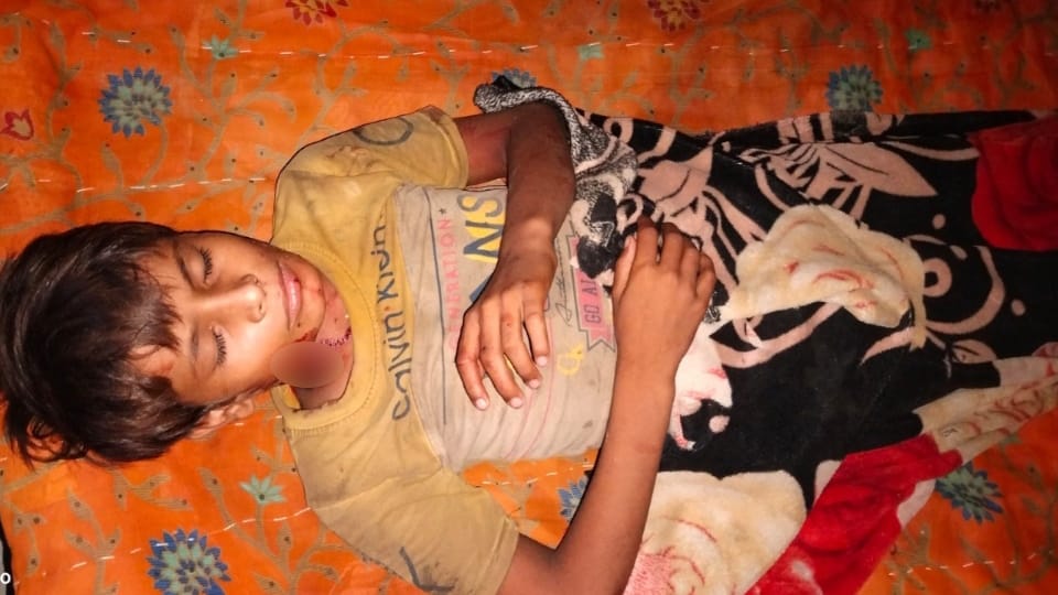 Bahraich: Man-eating wolf attacks child sleeping on terrace, referred to medical college in critical condition