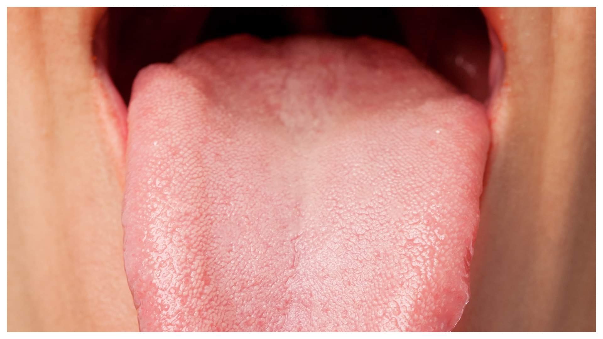 Health Tips Tongue Signs That Reveal Health Condition Jibh Se Kaise Pata Kare Kya Bimari Hai