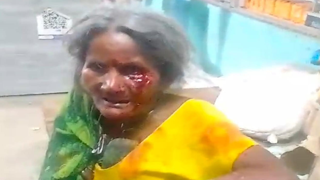 A wild animal has injured five people in Basti, the villagers surrounded and killed them