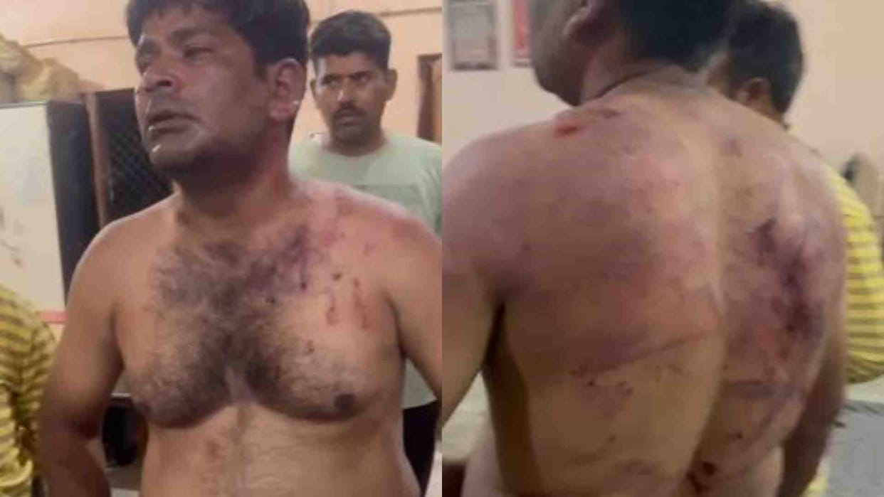 Gwalior News: When the money was not given for liquor, the miscreants beat up the petrol employees