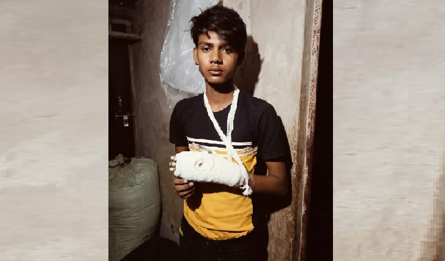 Students hand broken due to teachers beating, beaten for not doing homework, teacher denied the allegations