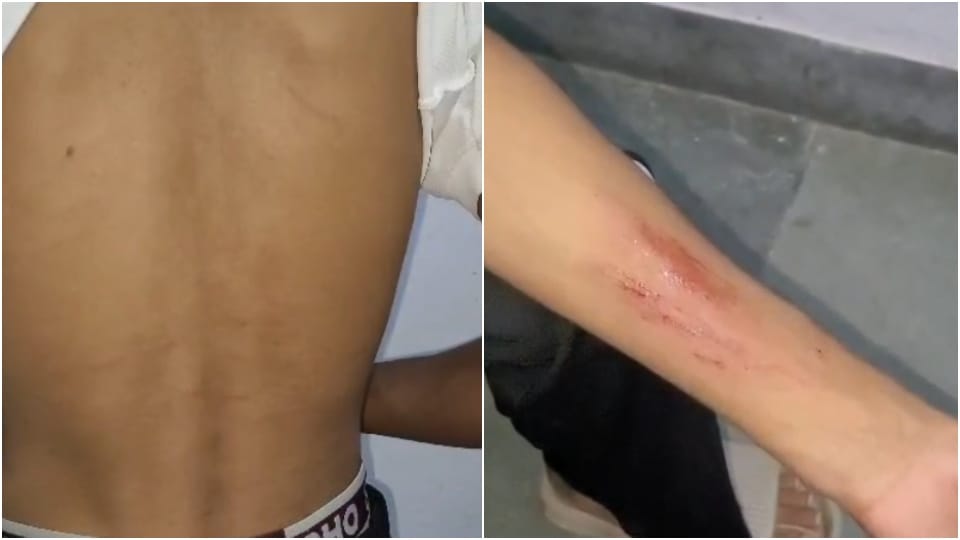 Alwar News: Teacher beats 17 year old student with slippers case registered