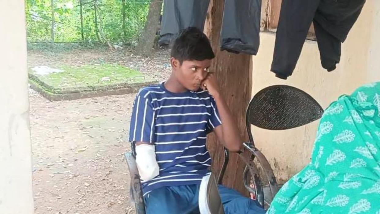 Korba: Minor laborer's hand chopped off, factory operator accused, plea for justice