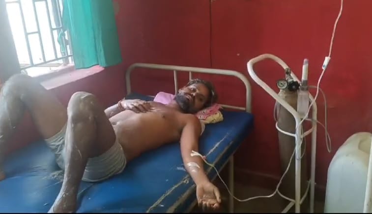 Cylinder caught fire after gas leakage, five people including Pradhans wife got burnt, admitted to hospital