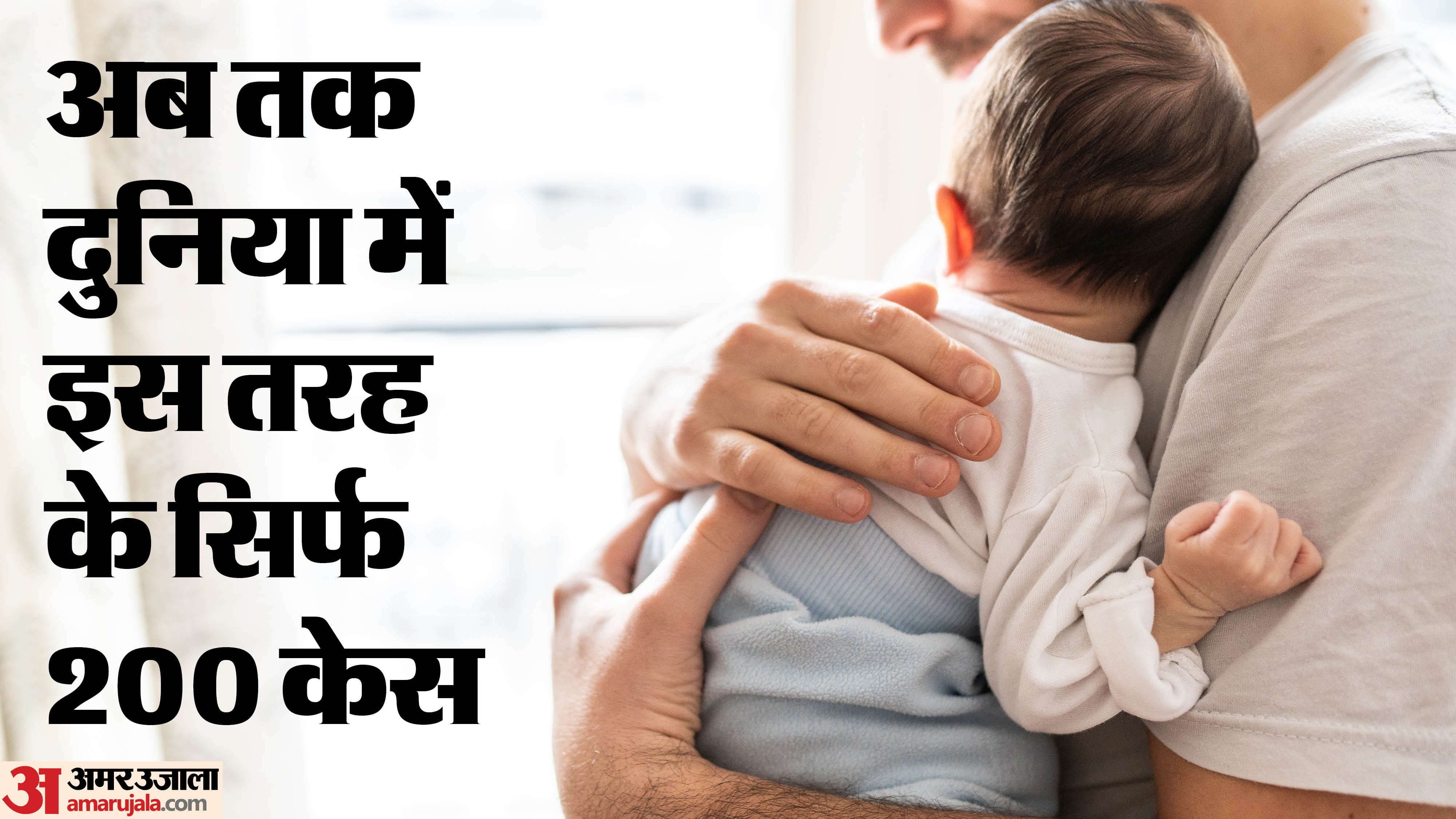 MP New Baby born with twin inside stomach Know Fetus in Fetu Medical Condition Report News in Hindi