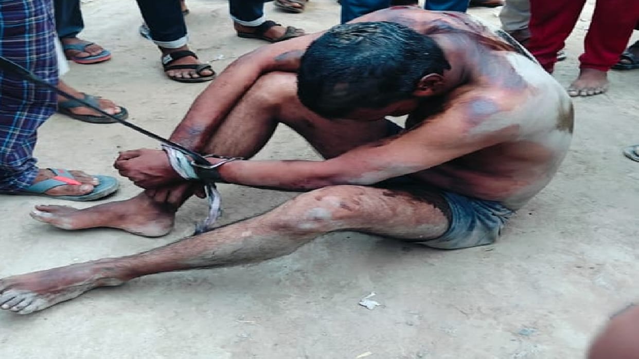 Moradabad: Exporter tortured worker for asking for PF, beat him badly, urinated on his face