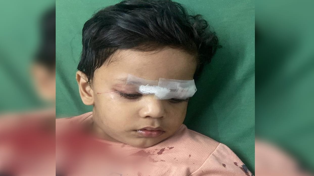 child got injured after getting entangled in Chinese manjha on flyover in bareilly
