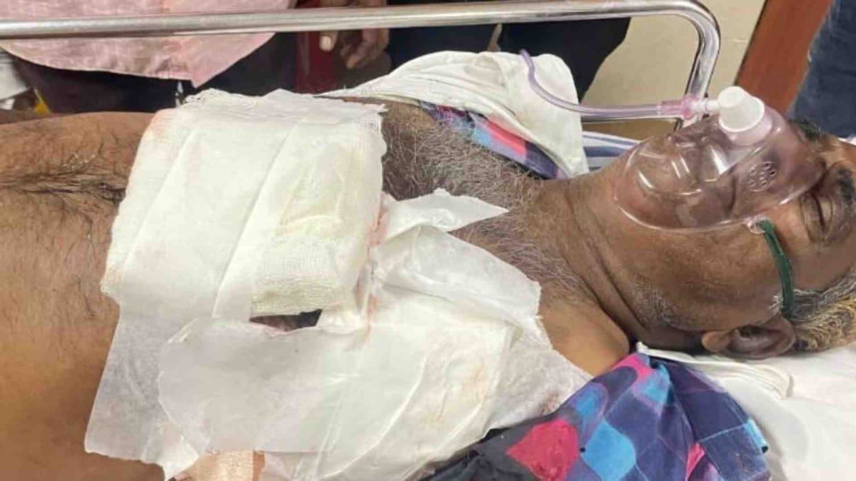 Jodhpur News: Band player got shot in celebratory firing at retirement event