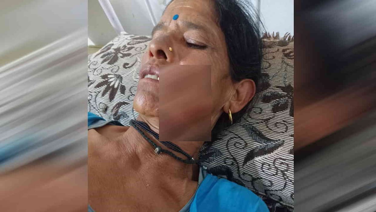 Leopard attacked a woman who had gone to collect grass in the forest in Pauri Tehsil Chaukisain
