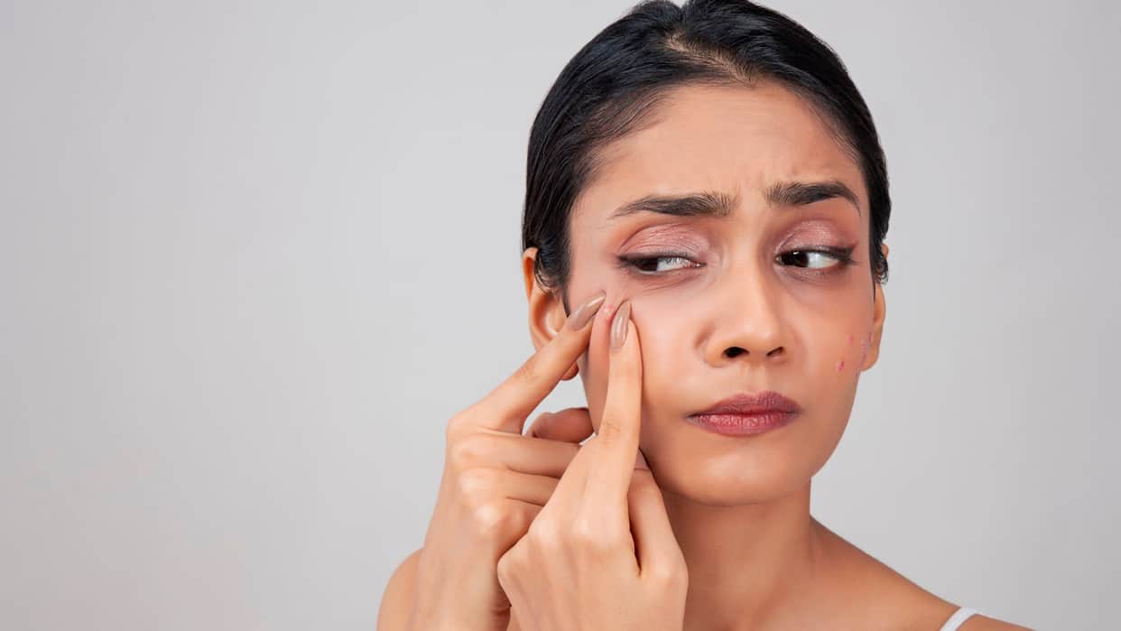 Skin Care Tips in hindi makeup karne se chehre par pimple ho jaye to kya kare